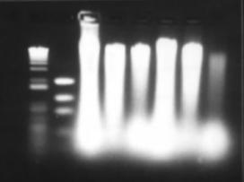 Bead-beater DNA extraction gel