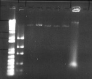 Plasmid DNA gel 5